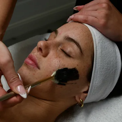 Carbon Facials