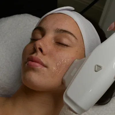 hifu-non-surgical-facelift