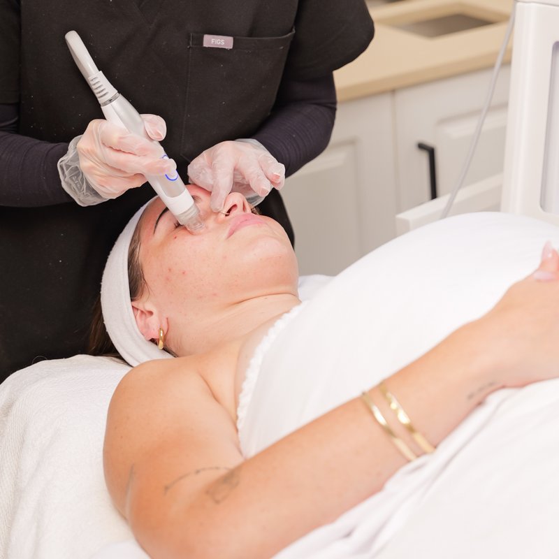 hydra-facial-treatment